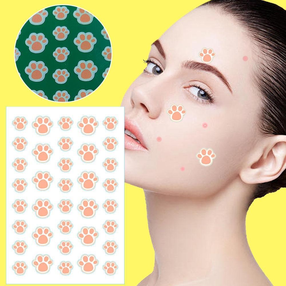 36pcs Cat Paw Acne Pimple Removal Patch Acne Hydrocolloid Stickersf