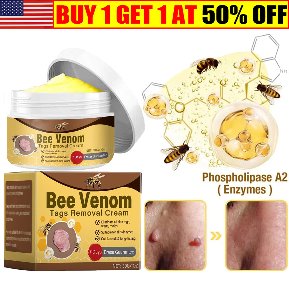 Bee Venom Comprehensive Cream, Bee Venom R-emoval Cream