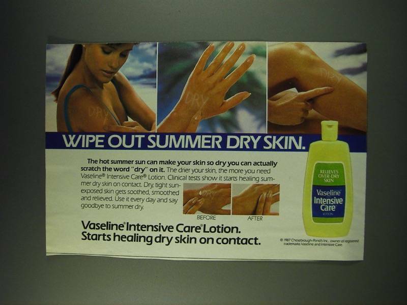 1987 Vaseline Intensive Care Lotion Ad for Summer Dry Skin Relief
