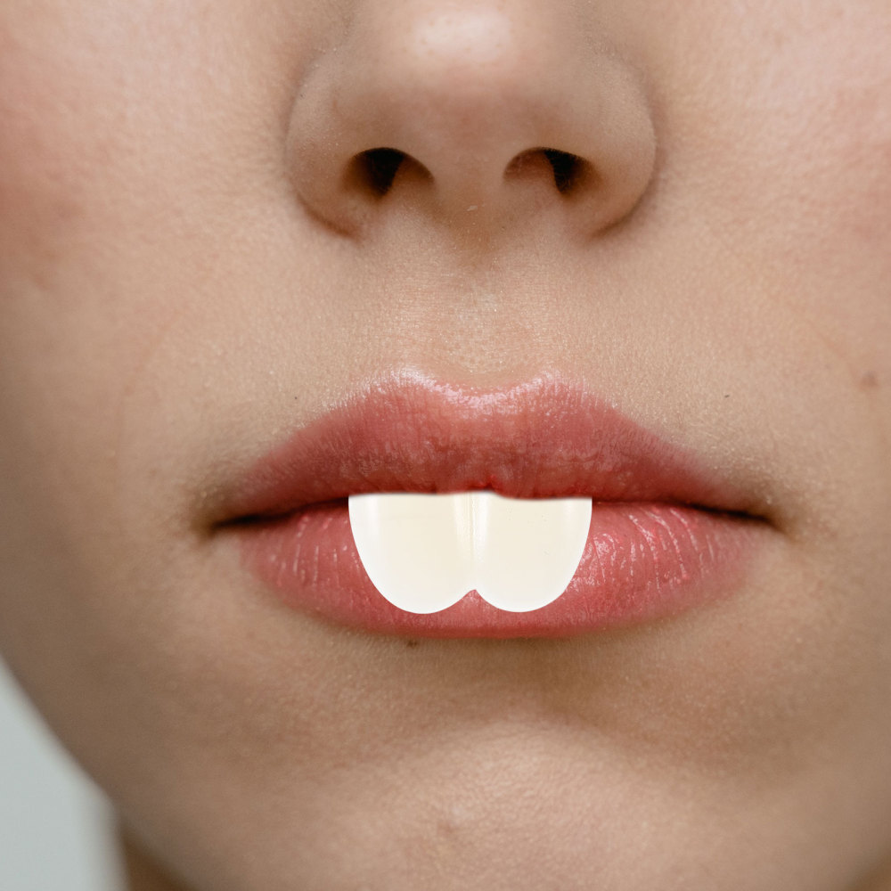 2 Pcs Fake Teeth Rabbit Dentures and Front Cos Props Bunny for Fun