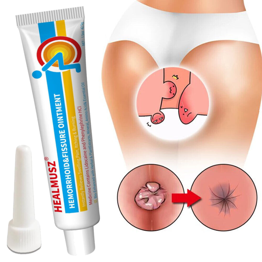 Herbal Hemorrhoids External Anal Fissure Treatment Ointment Cream Internal Piles